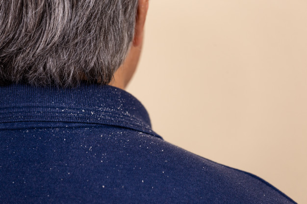 Stop dandruff